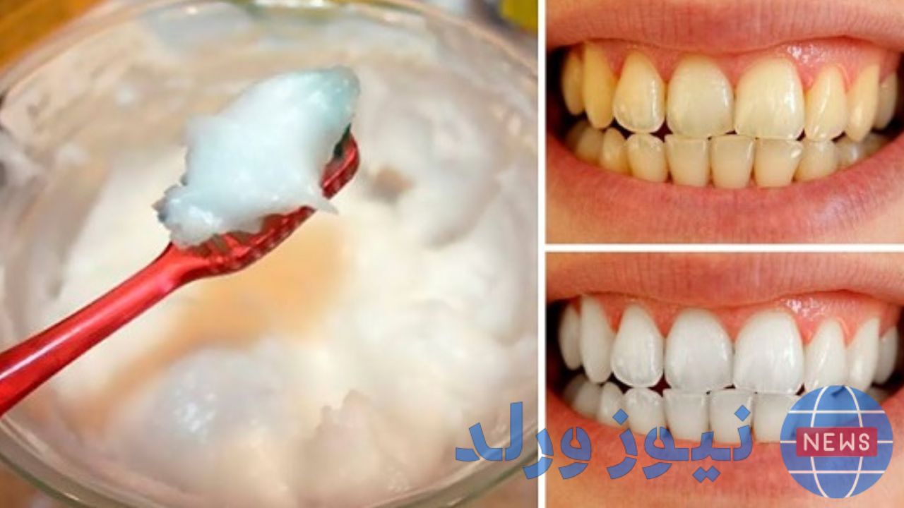 طريقة لتبييض الاسنان